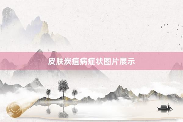 皮肤炭疽病症状图片展示